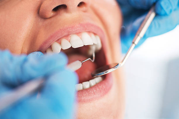 Broken Tooth Repair in Ladson SC - Experienced Emergency Dentist Open